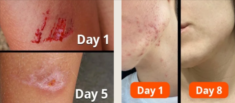 Active Skin Repair Spray benefits