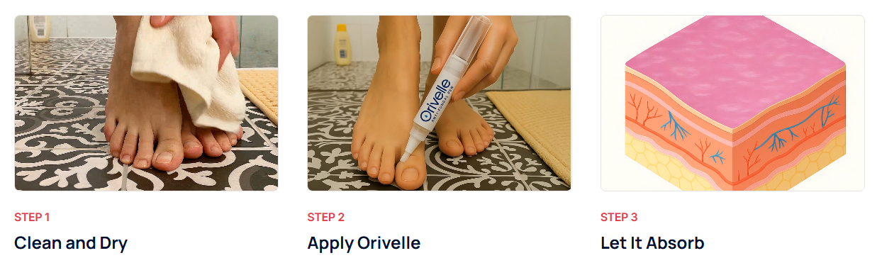 Orivelle Fungus Pen Uses