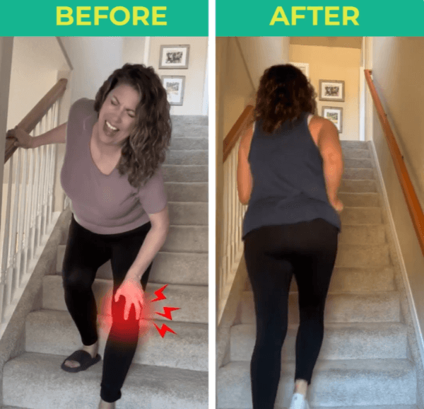 RejuvaKnee Before & After